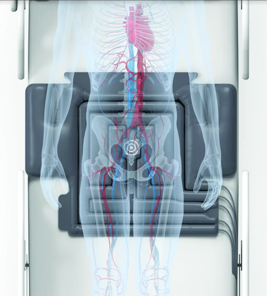 Turncare Product